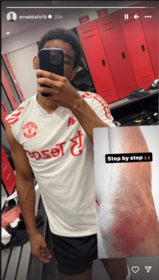 amad injury update on his knee